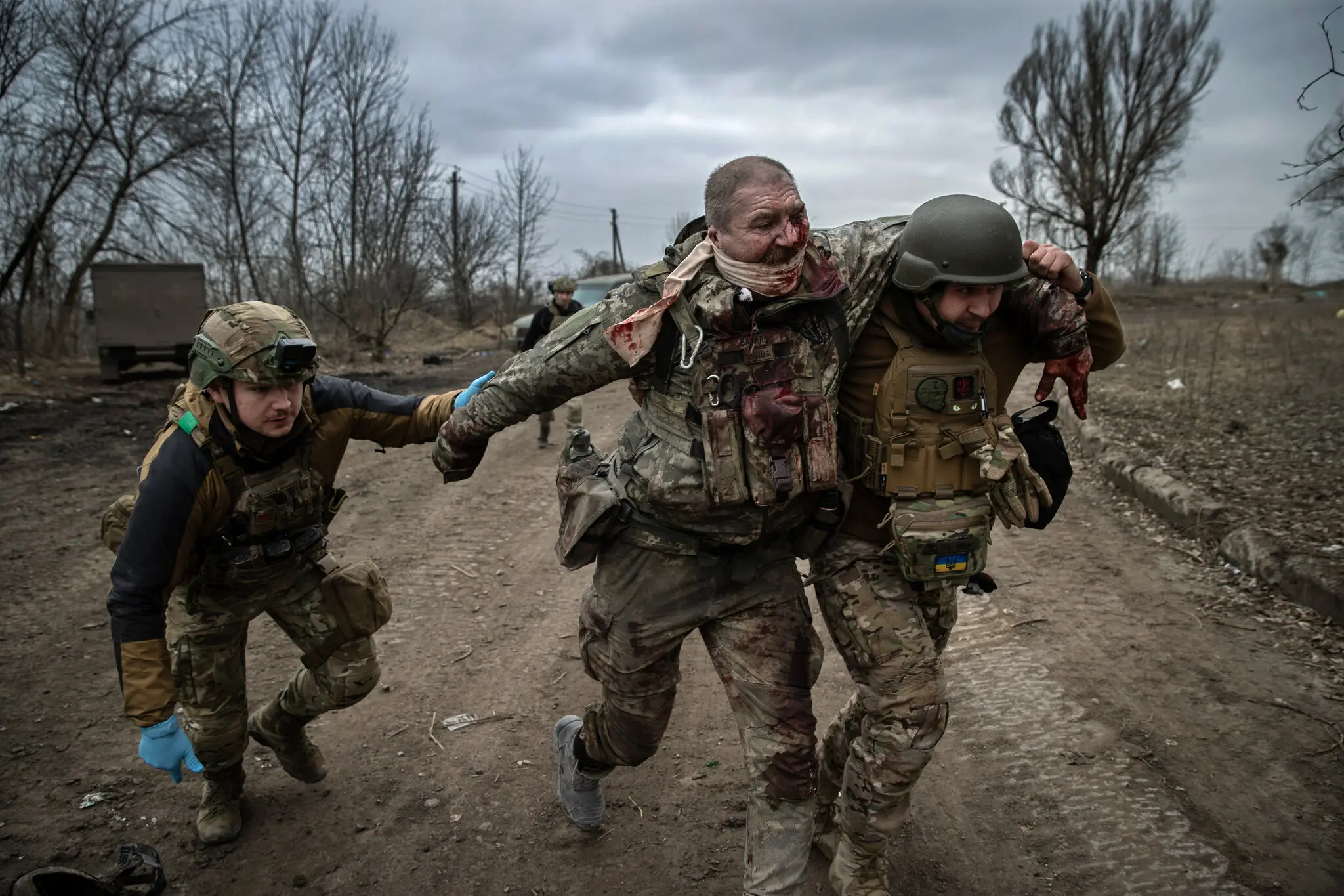 Медичний працівник 80-ї десантно-штурмової бригади надає допомогу українському військовослужбовцю 5-ї окремої десантно-штурмової бригади Василю Нікітіну Олександровичу, пораненому осколками в районі Бахмута 17 березня.